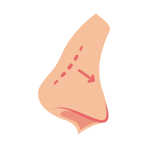 Rinoplastia o reparación de la nariz